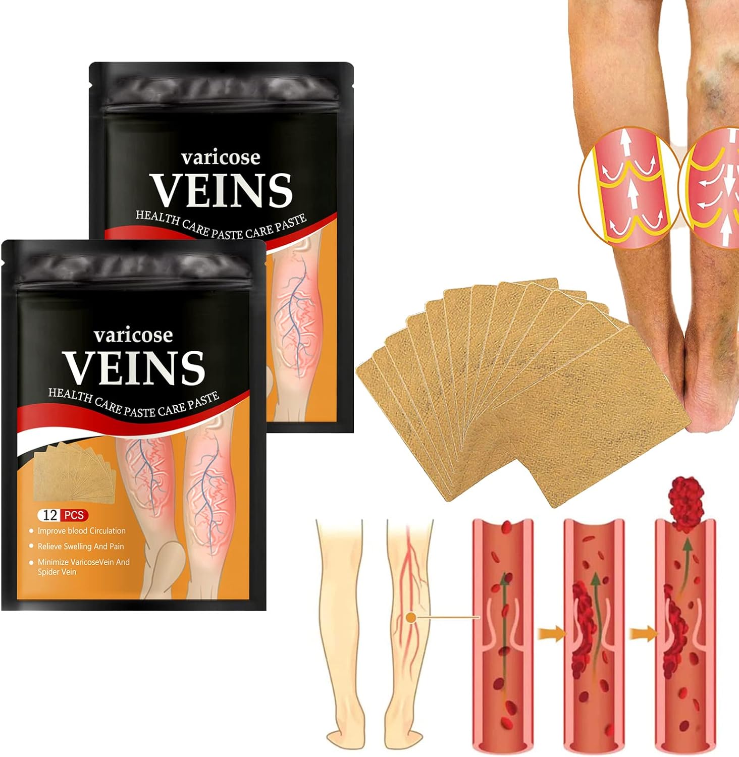 Parches Para Venas Varices