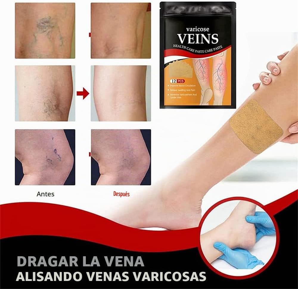 Parches Para Venas Varices